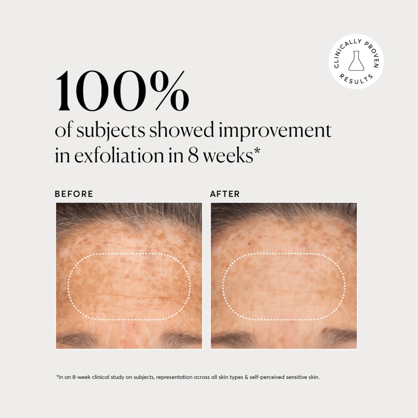 bha-liquid-exfoliant-2-a1 NATR-10027-Alt-Images-BHA-Liquid-Exfoliant-2_-03.webp