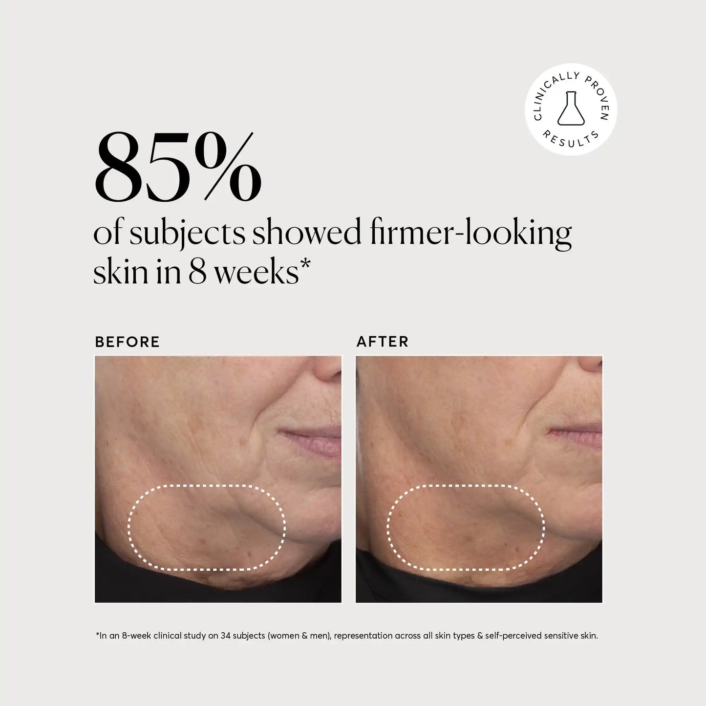 retinol-complex-serum-m6 NATR-10034-Alt-Images-Retinol-Complex-Serum-04.webp